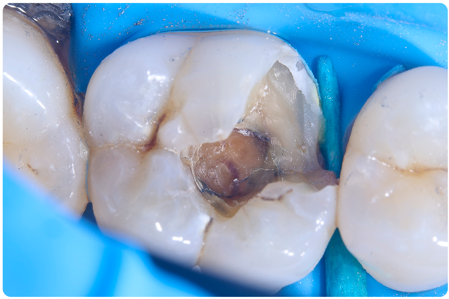 Case2_17-06-24_3